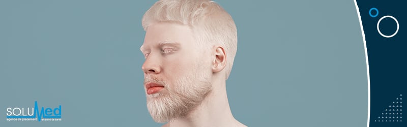 homme albinos, visage avec teint pâle, cheveux et barbe blanches